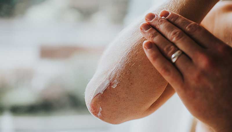 Understanding the Causes of Dry Skin