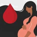 Understanding Postpartum Bleeding
