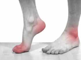 Understanding the Causes of Gout