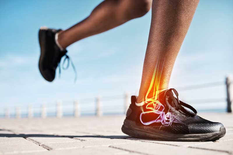 7 Effective Ankle Sprain Prevention Exercises